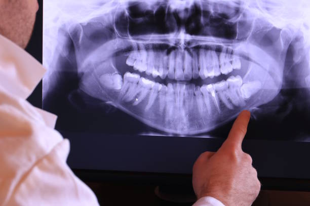 Best Emergency Treatment for Dental Infections or Abscesses in Reedspt, OR